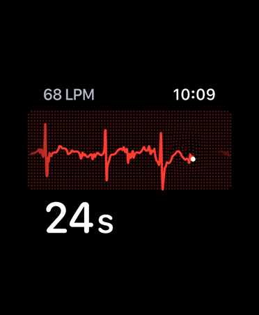 ECG app, beats per minute in top left corner, rhythm line, timer