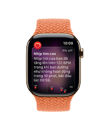 Apple Watch Series 11, titanium case gold color, High heart rate notification, Braided Solo Loop, turmeric color